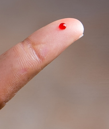 Une goutte de sang du patient suffit pour effectuer un test rapide d’orientation diagnostique (TROD).